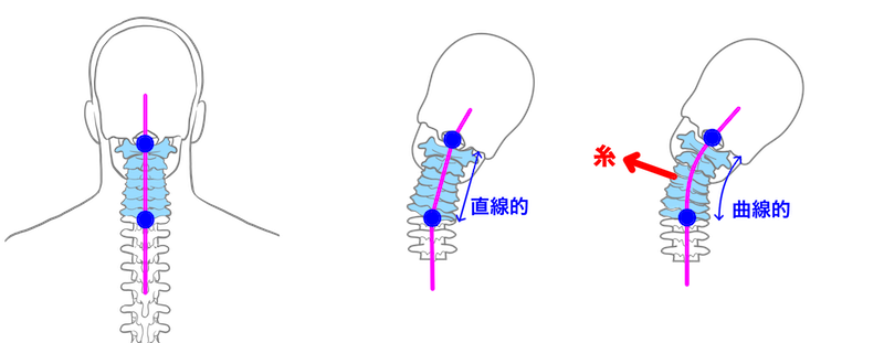 首をストレッチする時の良いイメージと悪いイメージ
